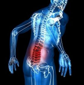 osteocondrose