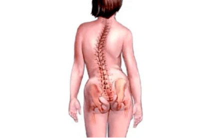 razões para o desenvolvimento de osteocondrose cervical