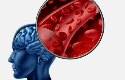 sintomas de osteocondrose da coluna cervical