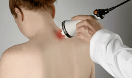 tratamento da osteocondrose cervical usando métodos de fisioterapia