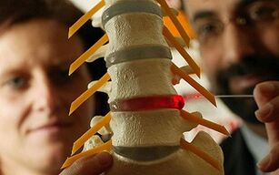 Sintomas e tratamento da osteocondrose da coluna torácica
