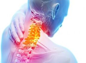 Dor e pontadas na região cervical com osteocondrose de terceiro grau